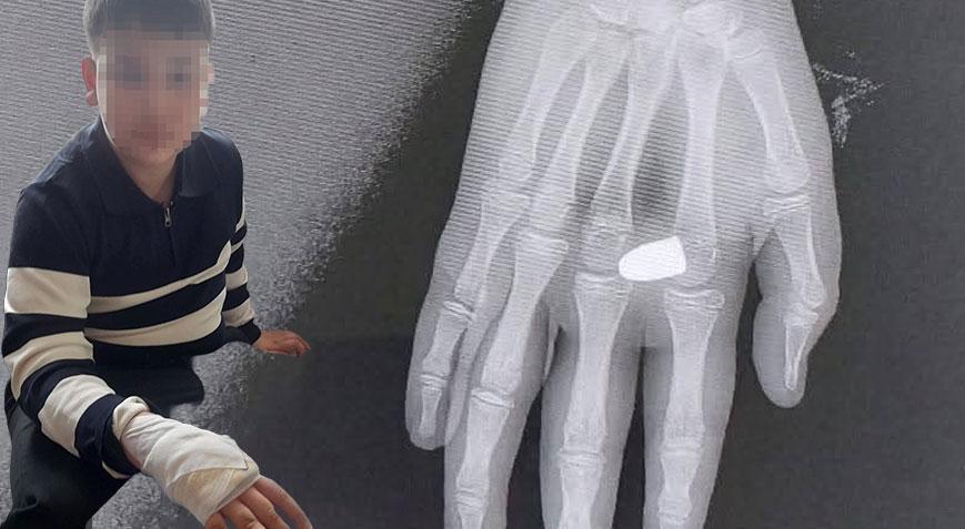 Oyun oynayan çocuk dehşeti yaşadı! ‘Bayram geleneği’ faciayla bitiyordu