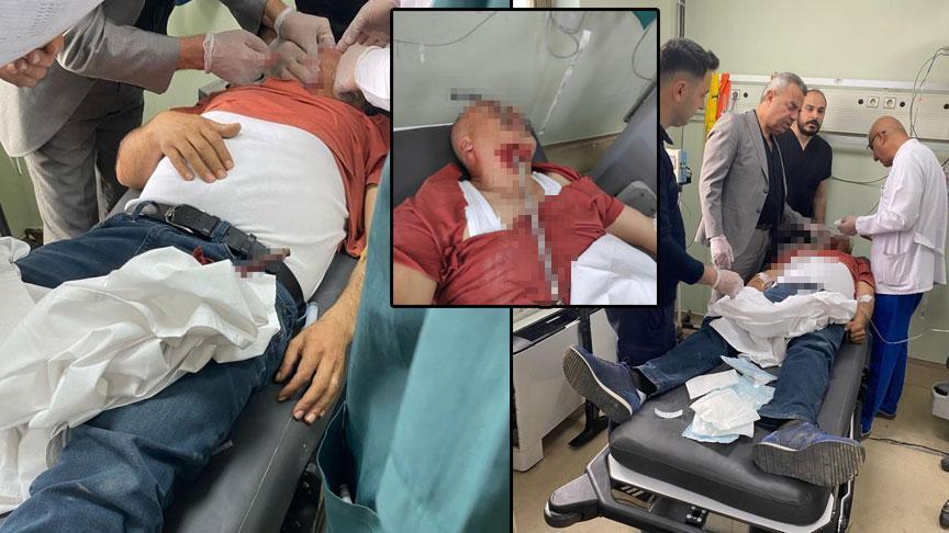 Hatay’da feci olay! İnşaat çalışanının yüzüne demir saplandı