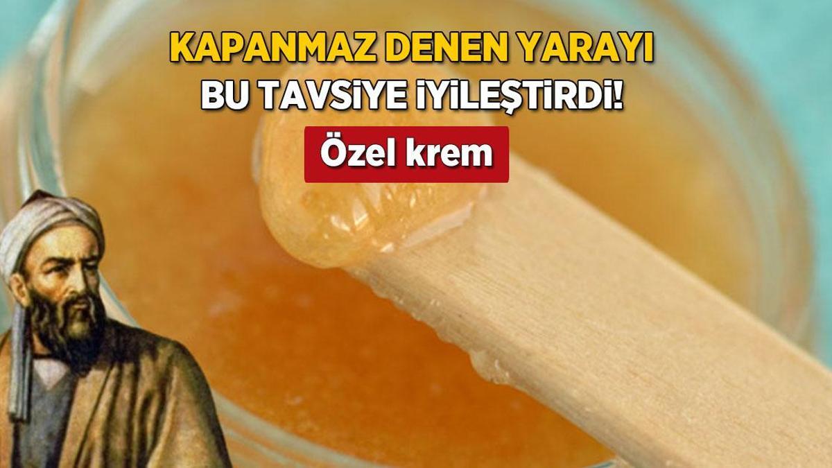 Kapanmaz yaraları kapayan İbn-i Sina kremi! 2 günde tesir ediyor, gücü doğal