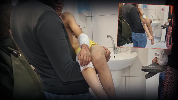 Malatya’da 9 yaşındaki Murat başıboş köpeklerin saldırısına uğradı