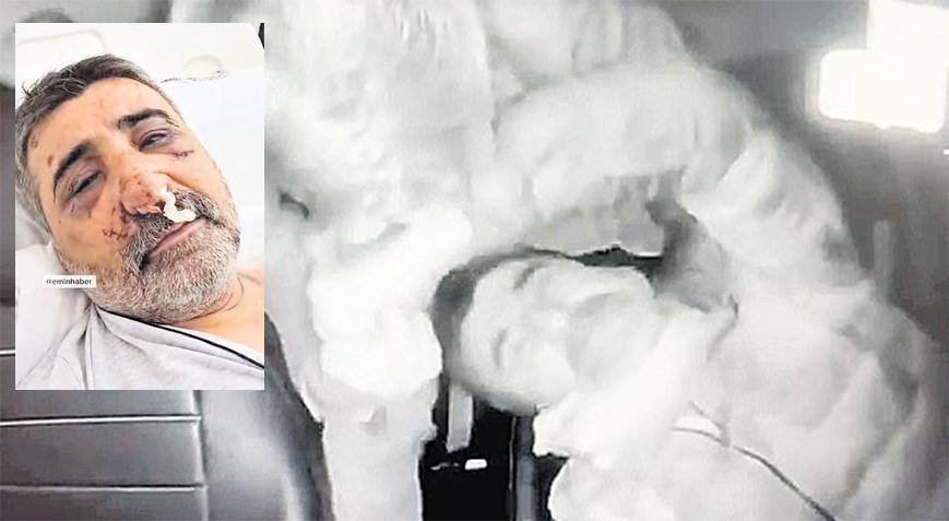Boksörün dövdüğü taksicinin ailesi: Türkiye’de yargılansın
