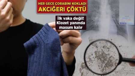 Her gece çorabını kokladı, akciğeri çöktü! Birinci olay değil: ‘Klozet yanında suçsuz kalır’
