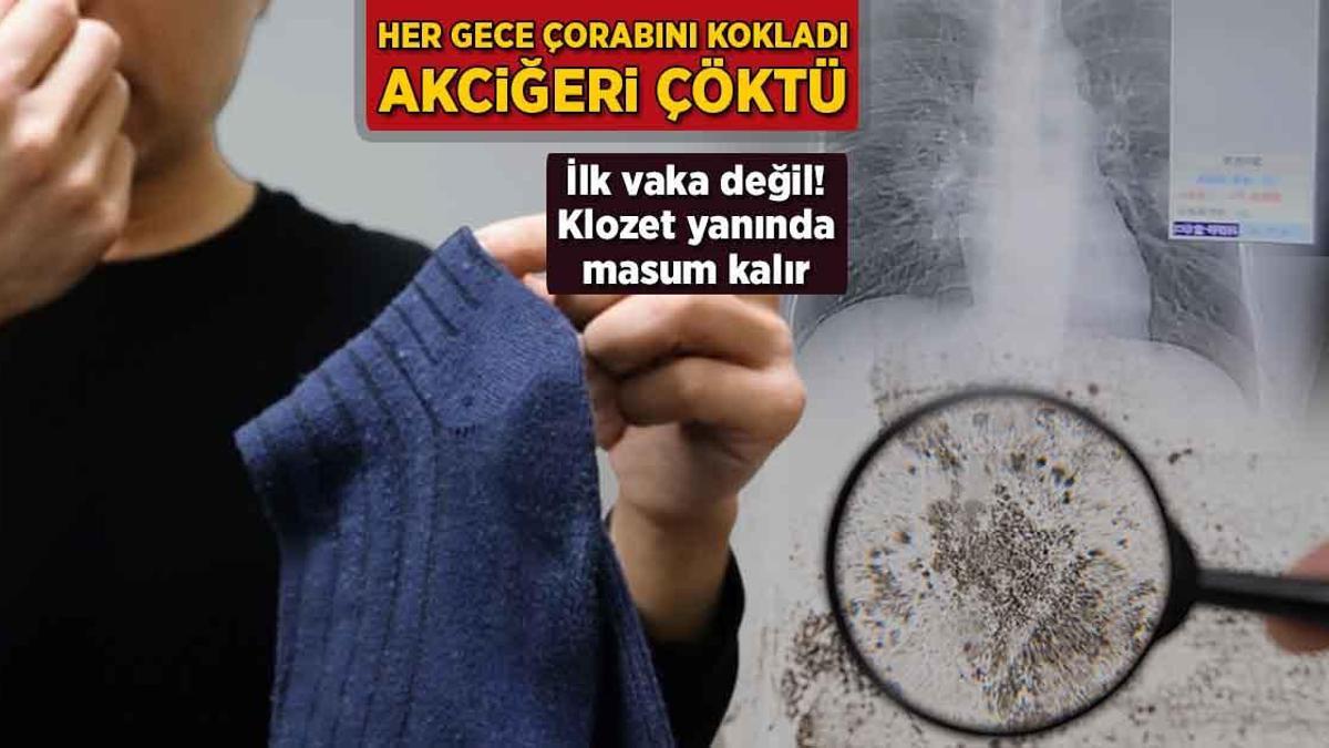 Her gece çorabını kokladı, akciğeri çöktü! Birinci olay değil: ‘Klozet yanında suçsuz kalır’