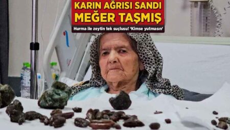 Karın ağrısı sandı, halbuki taşmış! Hurma ile zeytin tek hatalısı: ‘Kimse yutmasın’