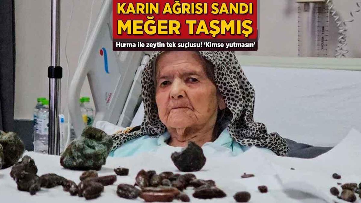 Karın ağrısı sandı, halbuki taşmış! Hurma ile zeytin tek hatalısı: ‘Kimse yutmasın’