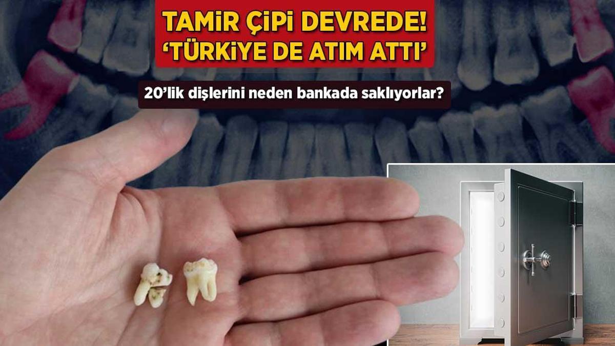 20’lik dişlerini bankada saklayan var! Tamir çipi devrede: ‘Türkiye de adım attı’