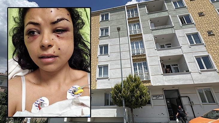 Düğünde tüfekli arbede: Pencereden izlerken, gözünden vuruldu