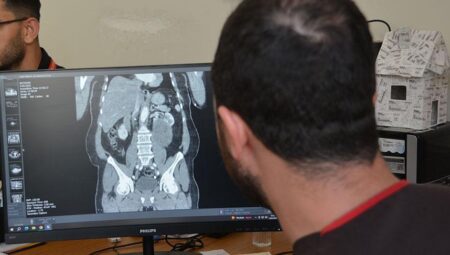 Karın şişliği için hastaneye gitti, hayatını şokunu yaşadı! ‘Neredeyse tamamını kaplamıştı’