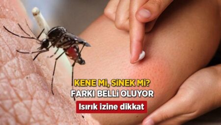 Kene mi yoksa sinek mi ısırdı? İz yuvarlaksa dikkat, anında aşikâr ediyor