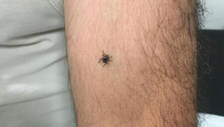 Panik büyüyor! Bir ilçede daha kene hadisesi görüldü