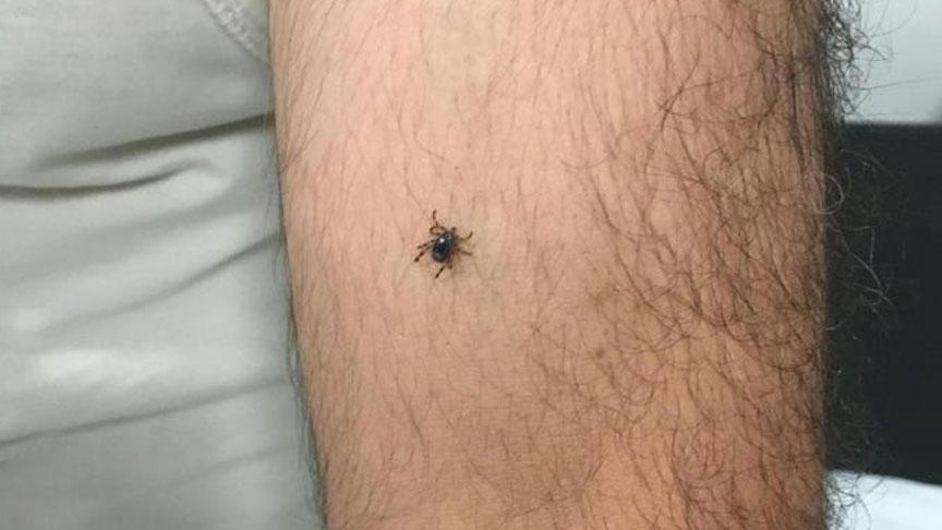 Panik büyüyor! Bir ilçede daha kene hadisesi görüldü
