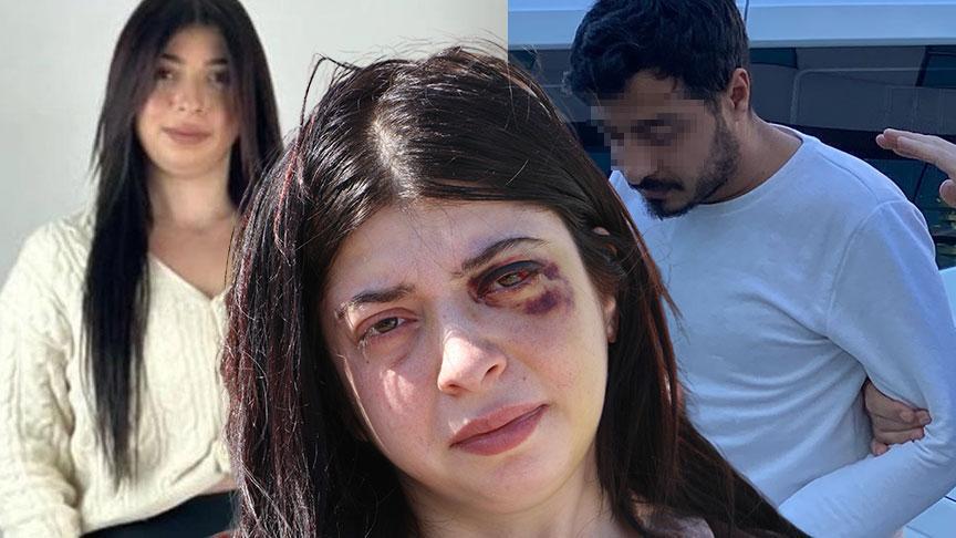Sokak ortasında taciz edip döndü, 12 hata kaydı ortaya çıktı! Şok karar