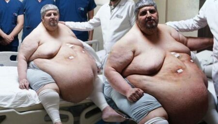 310 kiloya ulaştı! “Ölmek için dua ettim” dedi, yıllar sonra birinci adım