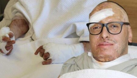 6 bin voltluk akıma kapıldı! Mevtten dönen genç mühendis Türkiye’de şifa buldu