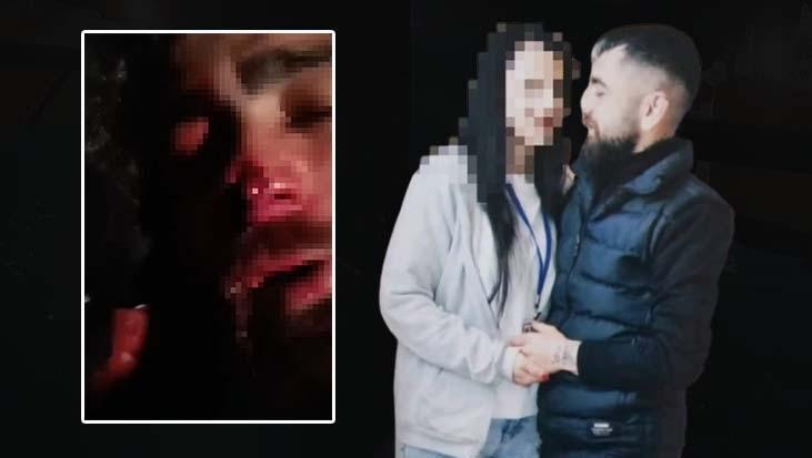 Ankara’da yasak aşk sonrası işkence! Babası ve ağabeyine yaptırdı