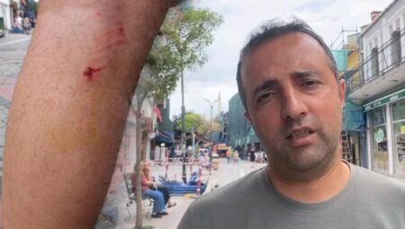 Edirne’de dehşet! 8 köpeğin saldırısına uğradı