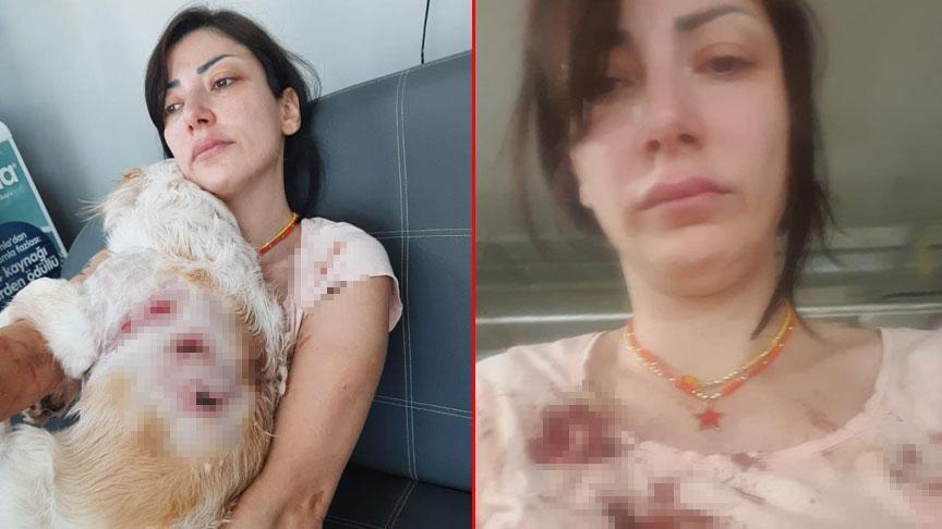 Genç bayan kan içinde kaldı! ‘Bacağımın gerisini parçaladılar’