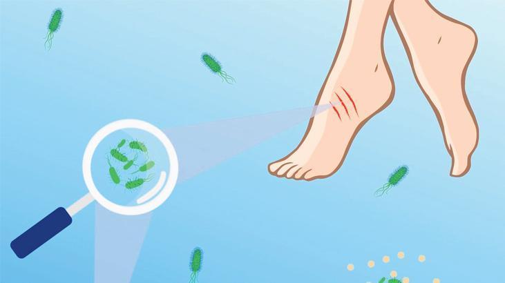Plajlarda ‘Vibrio’ alarmı! Açık yarayla denize girmeyin