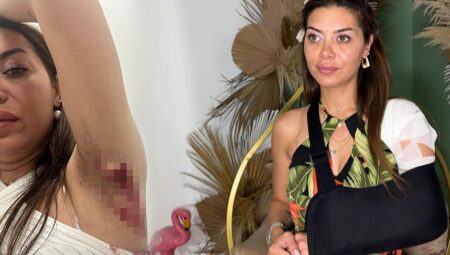 Sokakta yürürken jilet üzere kesikle yaralandı! ‘Kolumu kaybedebilirdim’