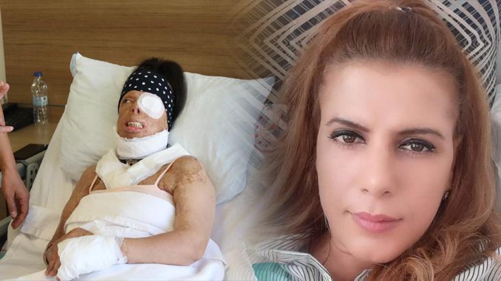‘Tatlı kelamlara kanmayın’ diyerek kabusu anlattı: Bergen’e misal bir kıssası var